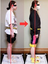 チャラク(charaku)/【20代F様：肩こり・スマホ首】