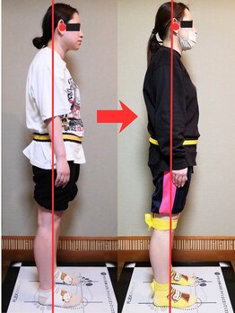 チャラク(charaku)/【20代F様：肩こり・スマホ首】