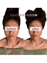 スカイ(sky)/頭蓋骨立体小顔矯正