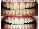 ヤット 森ノ宮(yatto.)の写真/都度払いメニューもご用意◎歯科衛生士によるホワイトニング施術で自信に満ち溢れた笑顔を♪