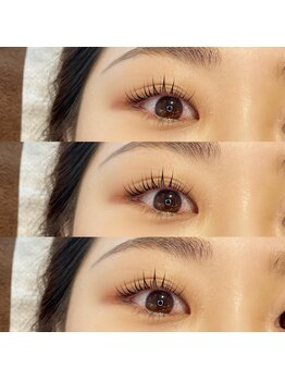 センスオブビューティー 東新宿店(SENSE OF BEAUTY)/他店お直しできます!