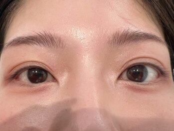 ノウル(Knowle)/マスカラパーマ(before)