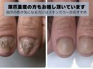 どこのネイルサロンでも断られた