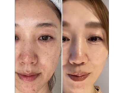 トータルエステティック ジョワイユ(JOYEUX)の写真