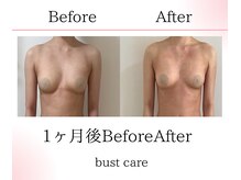 サロンツキ(salon tuki)/お客様症例/徳島バストケア