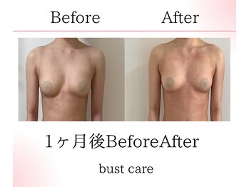 サロンツキ(salon tuki)/お客様症例/徳島バストケア