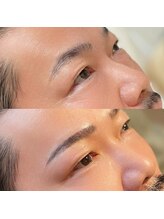 アンバーレス(AmberRes)/人気のストレートアーチ