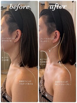 サロンドソエ(Salon de Soe)/上半身コース胸が開き呼吸が楽に