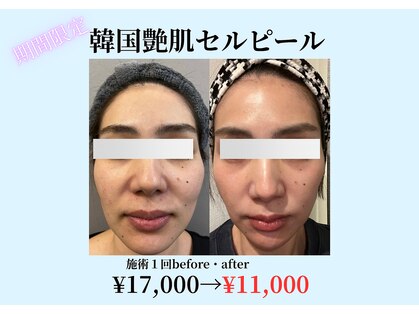 アルルプラス 山科(ARuru+)の写真