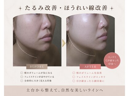 りたの写真