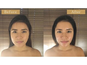 モモスパ(MOMOspa.)/頭蓋骨小顔矯正ビフォアフター