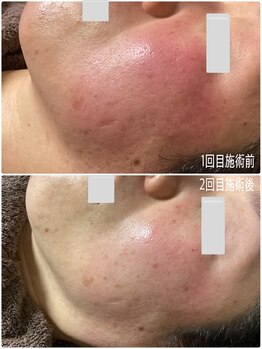 ブライトリー(Brightly)/嬉しいお声をいただいております