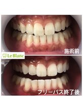 ルブラン 奈良店(Le Blanc)/デート前！お出かけ前にも！