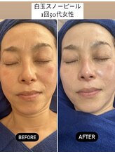 リジュベネ(rejuvena)/【結果出し本格美白コース！】