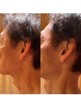 凪 横浜/免疫力と姿勢も関係あり！