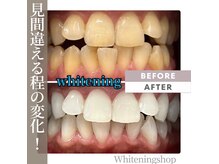ホワイトニングショップ 尾道店(WHITENING SHOP)