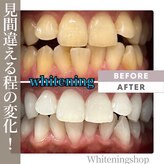 ホワイトニングショップ 尾道店(WHITENING SHOP)