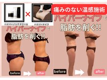 マイディア サロン(Mydear Salon)の雰囲気（温感施術のハイパーナイフで脂肪燃焼。筋膜リリース【ノンF】も）