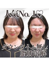 ミタメ 銀座店(MITAME)/お顔の脂肪を落としたい方に！