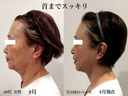 スキンスタジオ レア(Lea)の写真