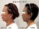 スキンスタジオ レア(Lea)の写真