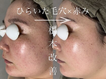 アンドエフ(&F)の写真