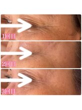 サロンジー(Salon Gee)/小じわ改善☆意外と簡単？！