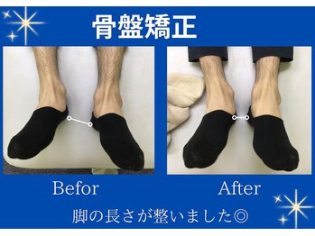 アミーゴ整体院/ビフォーアフター