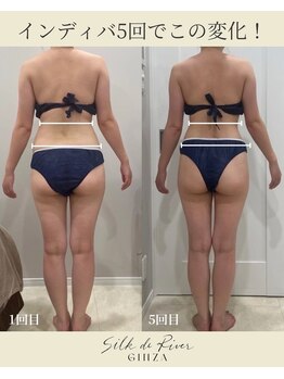 シルク ド ココ(Silk de Coco)/インディバボディ