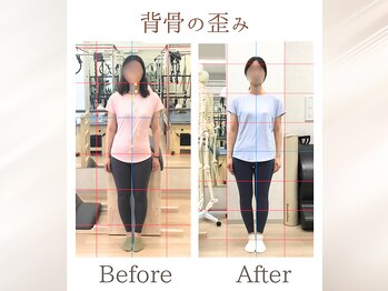 ラ ピラティス 横浜店(La pilates)/背骨の歪みが整い左右差が改善