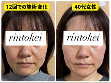 凛と慶/長居-美容鍼・ダイエット