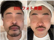 ビジュラン グロスキングツヤ王(Bijuran GlossKingツヤ王)の雰囲気(毛穴・くすみ・たるみも改善♪男性の肌悩みも根本からケア♪)