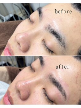 アモール 丸亀店(Amor)/眉毛/まつげパーマ/毛穴/脱毛