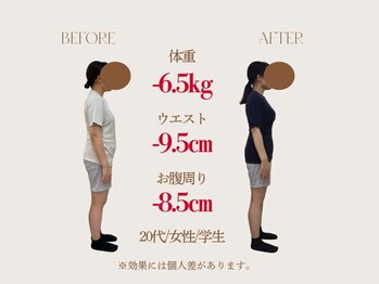 吉祥寺太子堂/ウエスト-9.5cm/20代/女性