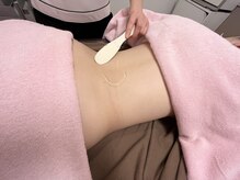 エイミー なんば店(ei-me)/【脱毛サロン/全身脱毛】腰脱毛