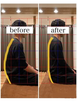 ナチュール(Nature)/猫背ビフォーアフター