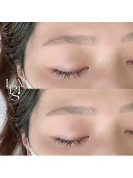 フレイズラピス(FRASE Lapis)/ハリウッドブロウリフト