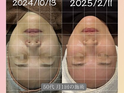 ミヨン(Miyong)の写真