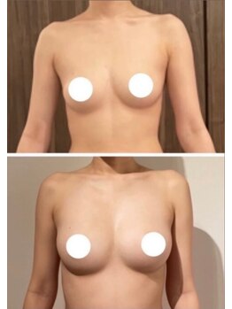 スマイルクルー(SmileClue)/ビフォーアフター症例