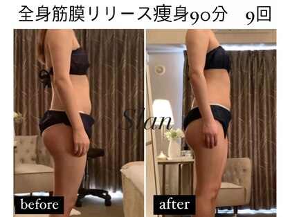 スラン(Slan)の写真