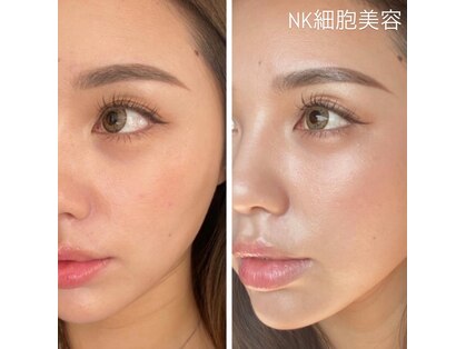 オルネ(ORNE.)の写真