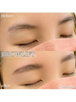 アイル(I'll)/ワックスでムダ毛をキレイに！