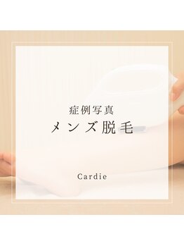 カルディエ(Cardie)/