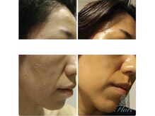 フローレ 平針店(Flore)/最短で結果を求める方へ