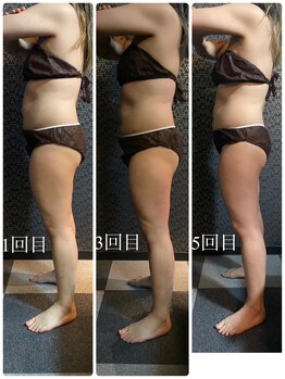 ラクラク(rakuraku)/全身痩身【全身】1~5回目