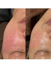 ミヨン(Miyong)/続けることでお肌は変わります！