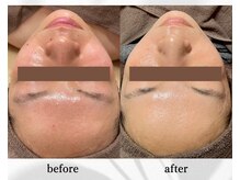 アン ビューティー(ann beauty)/リピーター様 30代