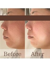 凪眠/小顔リンパフェイシャルの効果43