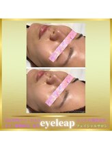 アイリープ(eyeleap)/☆【ララピール】韓国女優透明肌