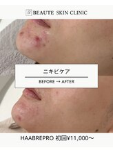 ボーテスキンクリニック/ハーブリプロ【HAAB】